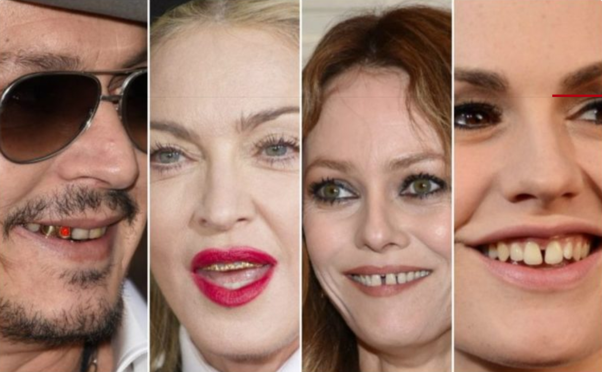 Bad Celebrity Teeth